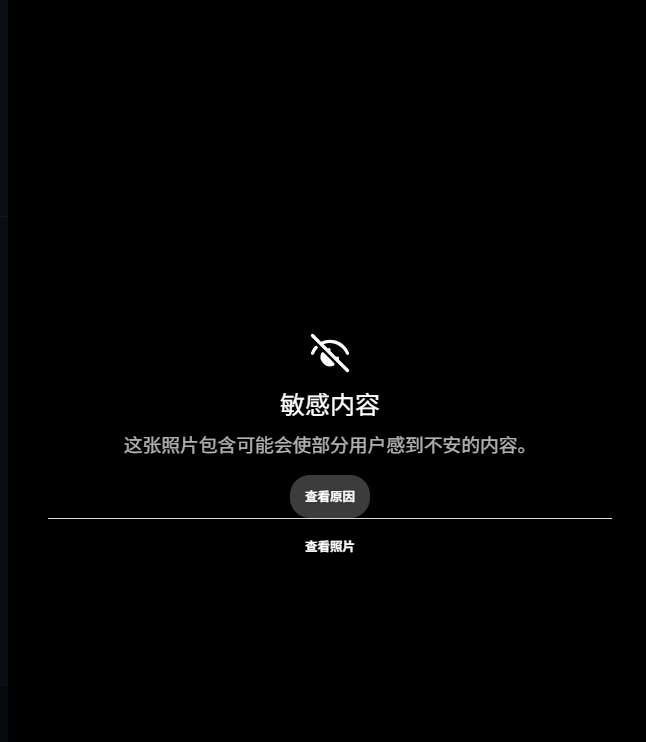范德比尔特右手小拇指脱臼刺穿皮肤，ESPN转发伤情图触发敏感锁定